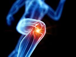 Joint Replacement