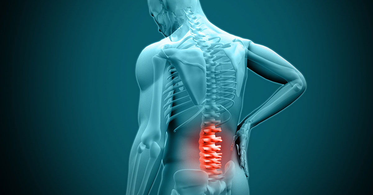 Lumber Spine Surgery