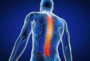 Spine Surgery